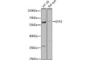 Western blot analysis of extracts of various cell lines, using EY antibody (ABIN7267073) at 1:1000 dilution. (EYA3 anticorps  (AA 1-300))