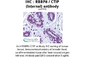 Image no. 1 for anti-Retinoblastoma Binding Protein 8 (RBBP8) (Internal Region) antibody (ABIN1738768) (Retinoblastoma Binding Protein 8 anticorps  (Internal Region))