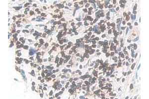 Detection of IL7R in Human Stomach Tissue using Polyclonal Antibody to Interleukin 7 Receptor (IL7R) (IL7R anticorps  (AA 173-260))