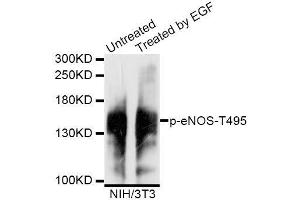 Western blot analysis of extracts of untreated and EGF-treated NIH/3T3 cells, using Phospho-eNOS-T495 antibody (ABIN5995598) at 1/1000 dilution.