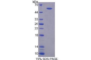 SDS-PAGE analysis of Rat RGS6 Protein. (RGS6 Protéine)