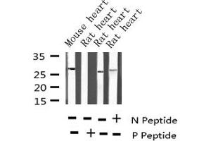 Western blot analysis of Phospho-TNNI3 (Thr142) expression in various lysates (TNNI3 anticorps  (pThr143))