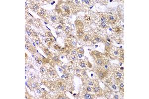 Immunohistochemistry of paraffin-embedded human liver injury using RPS10 antibody at dilution of 1:100 (x40 lens). (RPS10 anticorps)