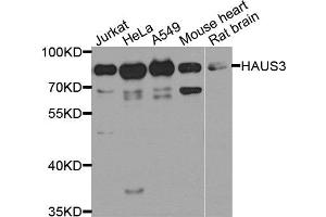 Western blot analysis of extract of various cells, using HAUS3 antibody. (HAUS3 anticorps)