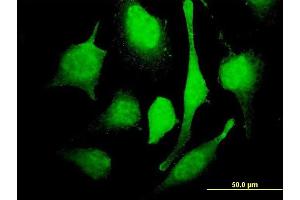 Immunofluorescence of monoclonal antibody to MARCH7 on HeLa cell.