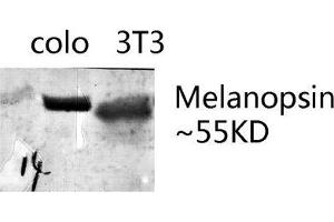 Western Blot (WB) analysis of specific lysis using Melanopsin Polyclonal Antibody. (OPN4 anticorps  (C-Term))