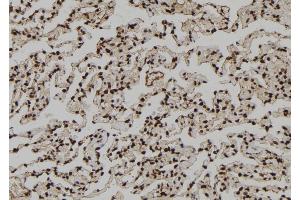 ABIN6273111 at 1/100 staining Human lung tissue by IHC-P. (DMAP1 anticorps  (Internal Region))