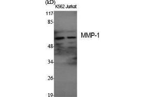 Western Blot (WB) analysis of specific cells using MMP-1 Polyclonal Antibody. (MMP1 anticorps  (C-Term))