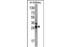 Western blot analysis of DDAH1 Antibody in mouse kidney tissue lysates (35ug/lane) (DDAH1 anticorps  (C-Term))