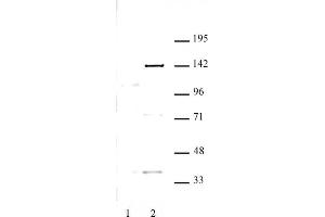 KDM4C antibody (pAb) tested by Western blot. (KDM4C anticorps)