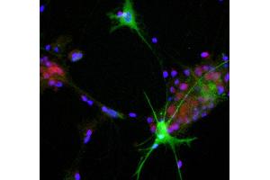 View of mixed neuron/glial cultures stained with ABIN1580409 (green) and our rabbit antibody to NeuN/FOX3 antibody (RPCA-FOX3, red). (ALDOC anticorps  (C-Term))
