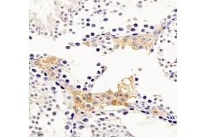 Immunohistochemistry of paraffin embedded mouse testis using Aldh4a1 (ABIN7073000) at dilution of 1: 1200 (400x lens)