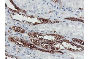 Image no. 1 for anti-phosphofructokinase, Platelet (PFKP) antibody (ABIN1500163) (PFKP anticorps)