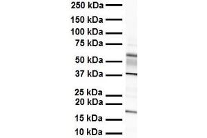 WB Suggested Anti-ZYX antibody Titration: 1 ug/mL Sample Type: Human heart (ZYX anticorps  (Middle Region))