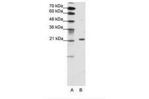 Image no. 1 for anti-Chromobox Homolog 1 (CBX1) (AA 61-110) antibody (ABIN202048) (CBX1 anticorps  (AA 61-110))