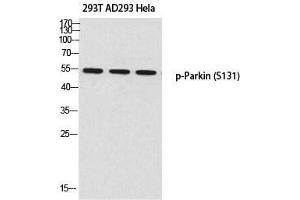 Western Blot (WB) analysis of 293T AD293 HeLa using p-Parkin (S131) antibody. (Parkin anticorps  (pSer131))