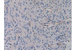 Used in DAB staining on fromalin fixed paraffin- embedded liver tissue (Integrin beta 3 anticorps  (AA 134-376))