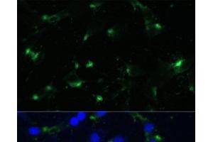 Immunofluorescence analysis of NIH-3T3 cells using ENO1 Polyclonal Antibody at dilution of 1:100. (ENO1 anticorps)