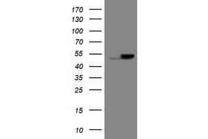 Image no. 1 for anti-Epoxide Hydrolase 1, Microsomal (Xenobiotic) (EPHX1) (AA 21-230) antibody (ABIN1491195) (EPHX1 anticorps  (AA 21-230))