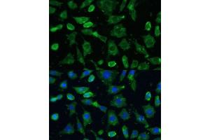 Immunofluorescence analysis of L-929 cells using SPARC Polyclonal Antibody (ABIN7270183) at dilution of 1:100 (40x lens).