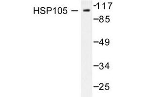 Image no. 2 for anti-Heat Shock 105kDa/110kDa Protein 1 (HSPH1) antibody (ABIN265469) (HSPH1 anticorps)