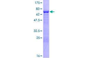 Image no. 1 for Cytohesin 2 (CYTH2) (AA 1-400) protein (GST tag) (ABIN1351036)