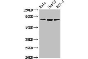 Western Blot Positive WB detected in: Hela whole cell lysate, HepG2 whole cell lysate, MCF-7 whole cell lysate All lanes: IMMT antibody at 3. (IMMT anticorps  (AA 76-215))