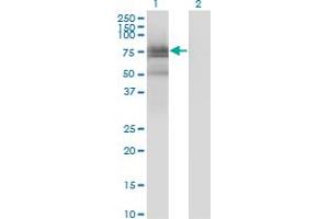 Western Blot analysis of BMX expression in transfected 293T cell line by BMX monoclonal antibody (M01), clone 3G3.