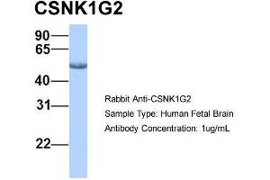 Host: Rabbit  Target Name: CSNK1G2  Sample Tissue: Human Fetal Brain  Antibody Dilution: 1. (Casein Kinase 1 gamma 2 anticorps  (Middle Region))
