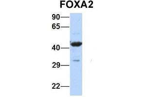 Host:  Rabbit  Target Name:  FOXA2  Sample Type:  Human 721_B  Antibody Dilution:  1. (FOXA2 anticorps  (Middle Region))