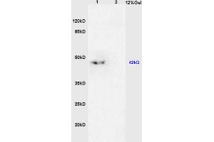 L1 mouse brain lysates, L2 mouse kidney lysates probed with Anti- TGF beta 2 Propeptide Polyclonal Antibody, Unconjugated (ABIN724880) at 1:200 in 4 °C. (TGF beta 2 Propeptide (AA 154-197) anticorps)