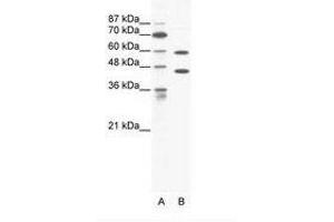 Image no. 1 for anti-Cation Channel, Sperm Associated 2 (CATSPER2) (C-Term) antibody (ABIN203196) (CATSPER2 anticorps  (C-Term))
