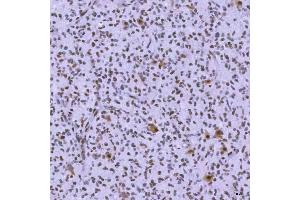 IHC analysis of SNRNP200 using anti-SNRNP200 antibody (ABIN7602032).