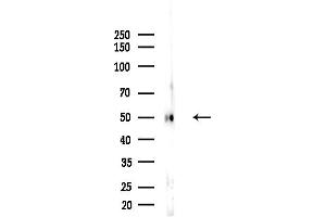 anti-Chromosome 13 Open Reading Frame 18 (C13orf18) (N-Term) antibody