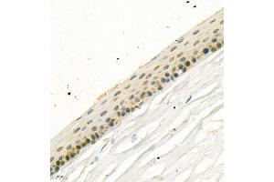 Immunohistochemistry of paraffin embedded rat eye using SLC7A14 (ABIN7075683) at dilution of 1:700 (400x lens) (SLC7A14 anticorps)
