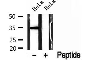 Western blot analysis of extracts of HeLa cells, using GOLPH3 antibody. (GOLPH3 anticorps  (C-Term))