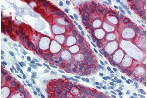 Immunohistochemistry staining of human colon (paraffin sections) using anti-cytokeratin 18 (clone DA-7). (Cytokeratin 18 anticorps)