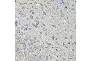 Immunohistochemistry of paraffin-embedded mouse brain using CDK10 antibody.