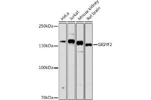 Western blot analysis of extracts of various cell lines, using GIGYF2 antibody (ABIN6132175, ABIN6141083, ABIN6141084 and ABIN6215640) at 1:1000 dilution. (GIGYF2 anticorps  (AA 350-500))