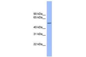 Image no. 1 for anti-Colony Stimulating Factor 1 (Macrophage) (CSF1) (AA 215-264) antibody (ABIN6743293) (M-CSF/CSF1 anticorps  (AA 215-264))