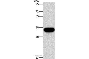 Western blot analysis of PC3 cell, using HOXB13 Polyclonal Antibody at dilution of 1:900 (HOXB13 anticorps)