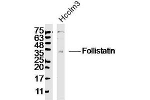 Lane 1: HCCLM3 lysates, probed with Follistatin Polyclonal Antibody, Unconjugated  at 1:300 dilution and 4˚Covernight incubation. (Follistatin anticorps  (AA 151-250))