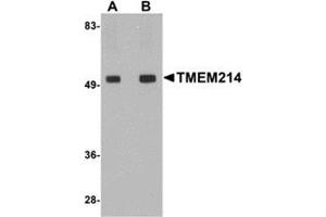 Western blot analysis of TMEM214 in rat brain tissue lysate with this product at (A) 1 and (B) 2 μg/ml. (TMEM214 anticorps  (Center))