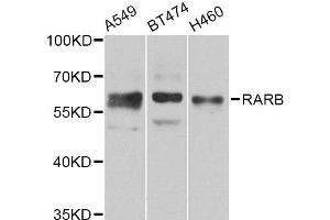 Western blot analysis of extracts of various cell lines, using RARB Antibody (ABIN2737447) at 1:1000 dilution.