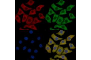 eEF2K Mouse Monoclonal Antibody staining HepG2 cells by IF/ICC. (EEF2K anticorps  (Internal Region))