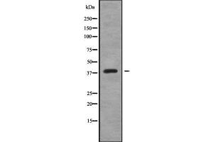 Western blot analysis of CREB3L4 using K562 whole cell lysates (CREB3L4 anticorps  (Internal Region))