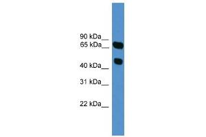 WB Suggested Anti-SYT16 Antibody Titration: 0. (SYT16 anticorps  (N-Term))