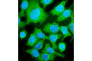 IF analysis of ALDOB using anti-ALDOB antibody (ABIN7602563). (ALDOB anticorps  (AA 85-364))