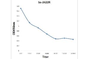 Formalin-fixed and paraffin embedded rat brain labeled with Anti-Bdkrb2/B2R Polyclonal Antibody, Unconjugated (ABIN740040) at 1:200 followed by conjugation to the secondary antibody and DAB staining.