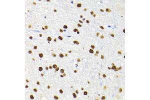 Immunohistochemistry of paraffin-embedded mouse spinal cord using K/K/TRIM28 Rabbit pAb  at dilution of 1:200 (40x lens). (KAP1 anticorps  (AA 576-835))